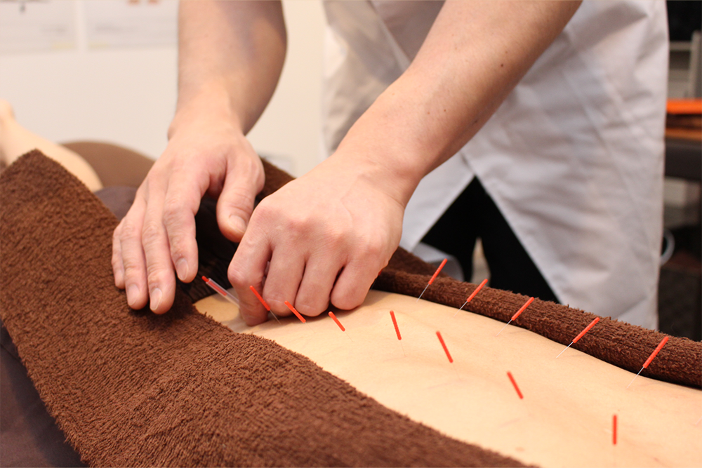 自律神経失調症