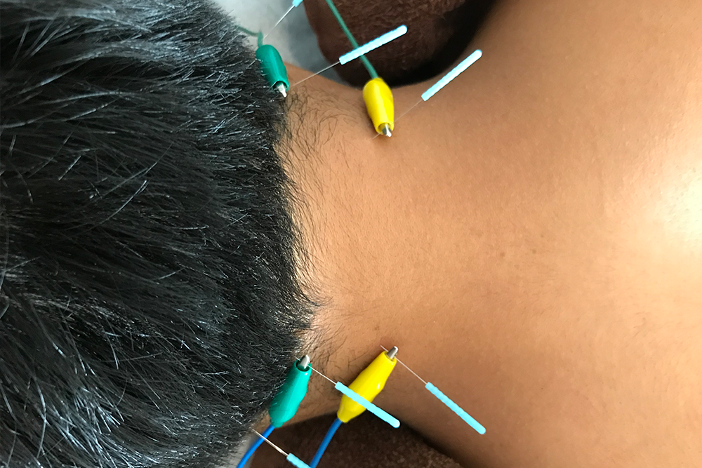 慢性的な痛み（頭/首/肩/腰/脚）